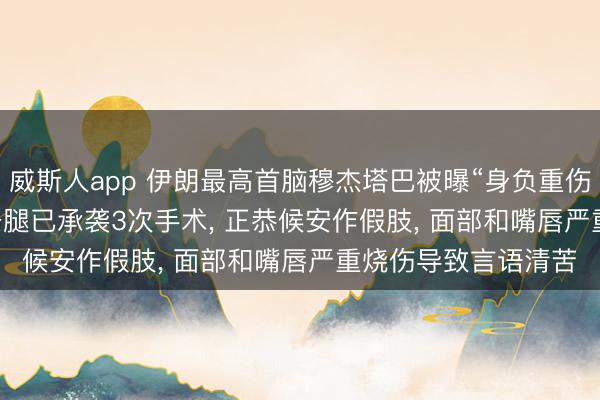 威斯人app 伊朗最高首脑穆杰塔巴被曝“身负重伤， 仍控全局”: 其一条腿已承袭3次手术， 正恭候安作假肢， 面部和嘴唇严重烧伤导致言语清苦